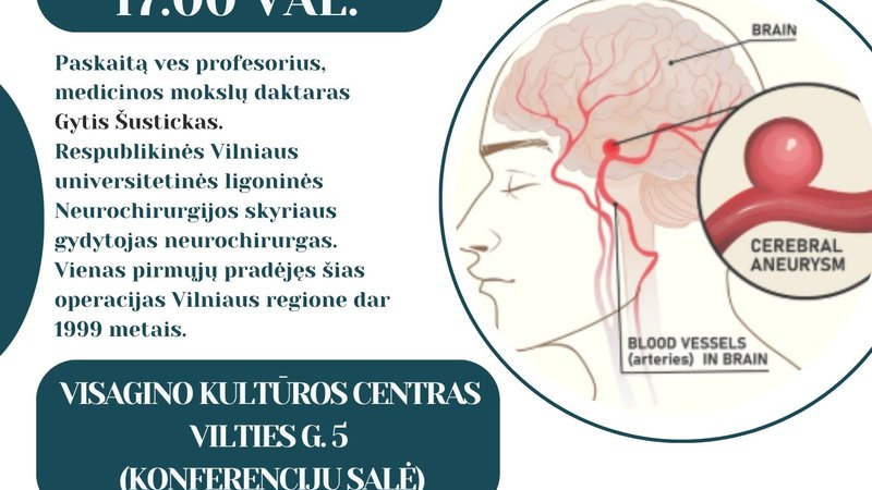 Аневризма мозга: как не пропустить опасность – лекция профессора в Висагинасе - Реклама